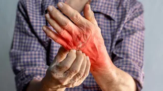 5 Easy And Effective Ways To Eliminate Fungal Infections During The Rainy Season